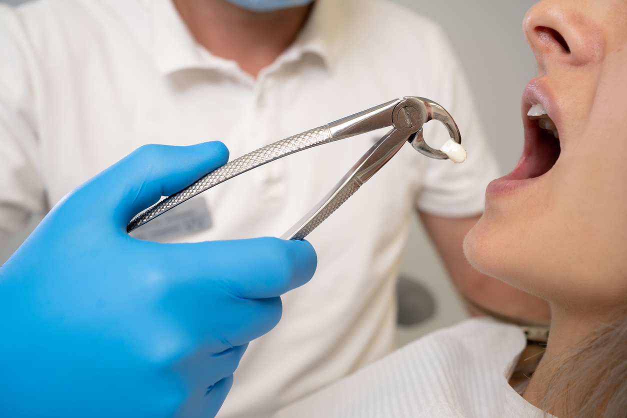 Root Canal & Tooth Extraction